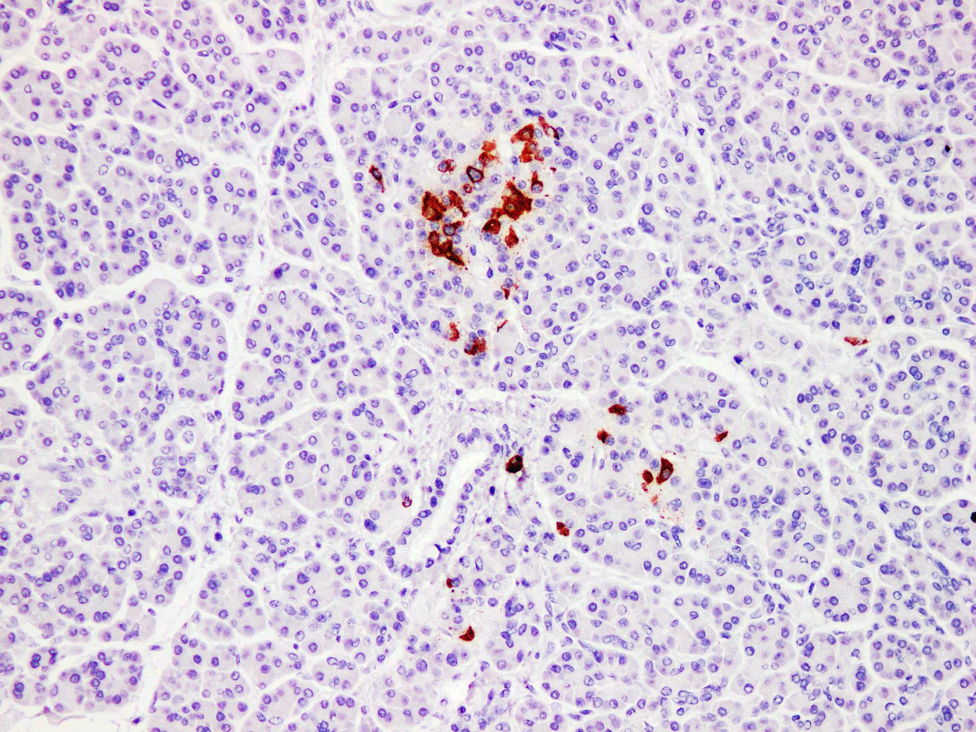 Pathological Antibodies