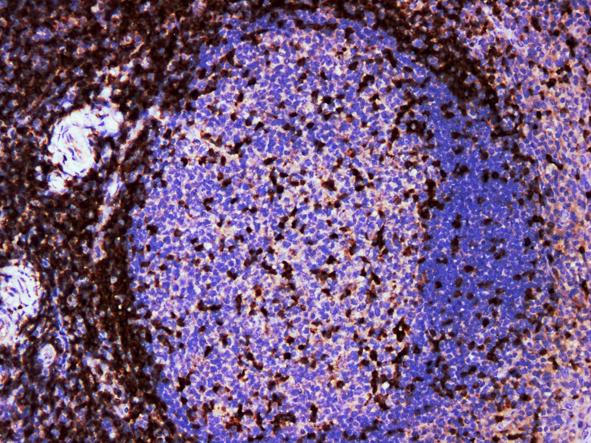 Pathological Antibodies