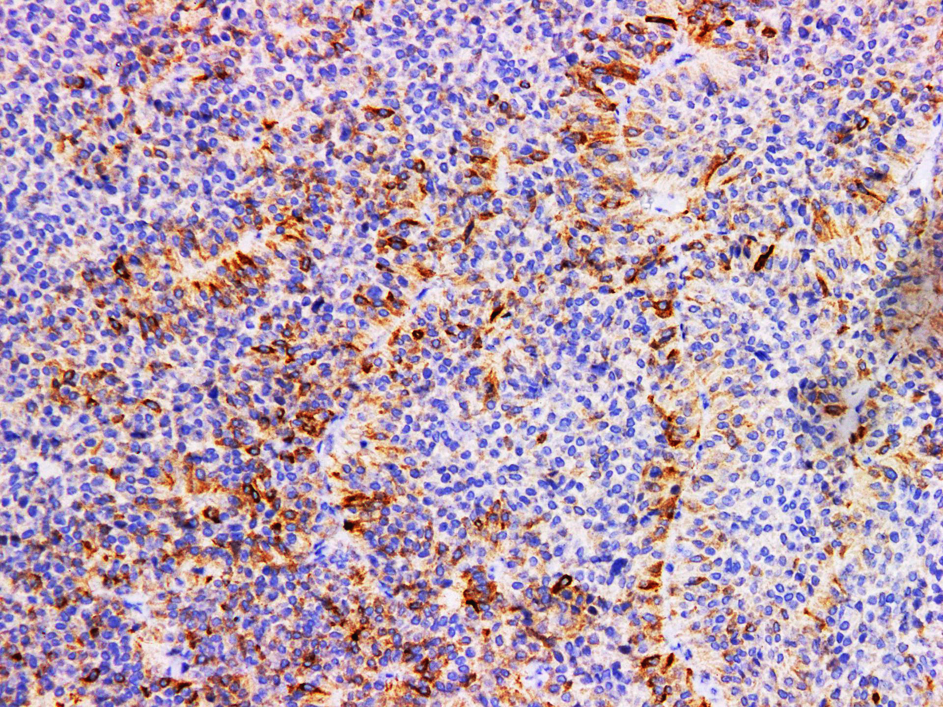 Pathological Antibodies