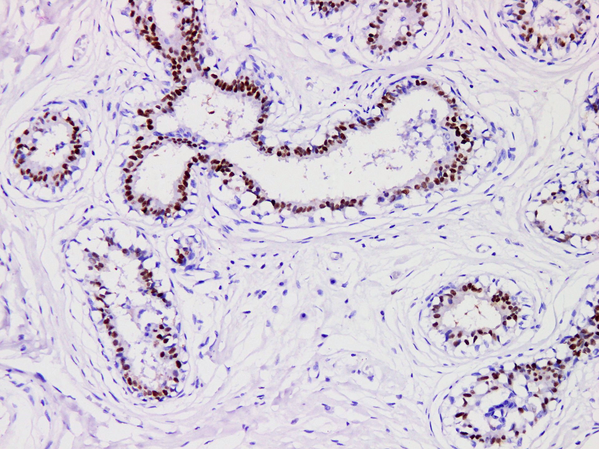 Pathological Antibodies