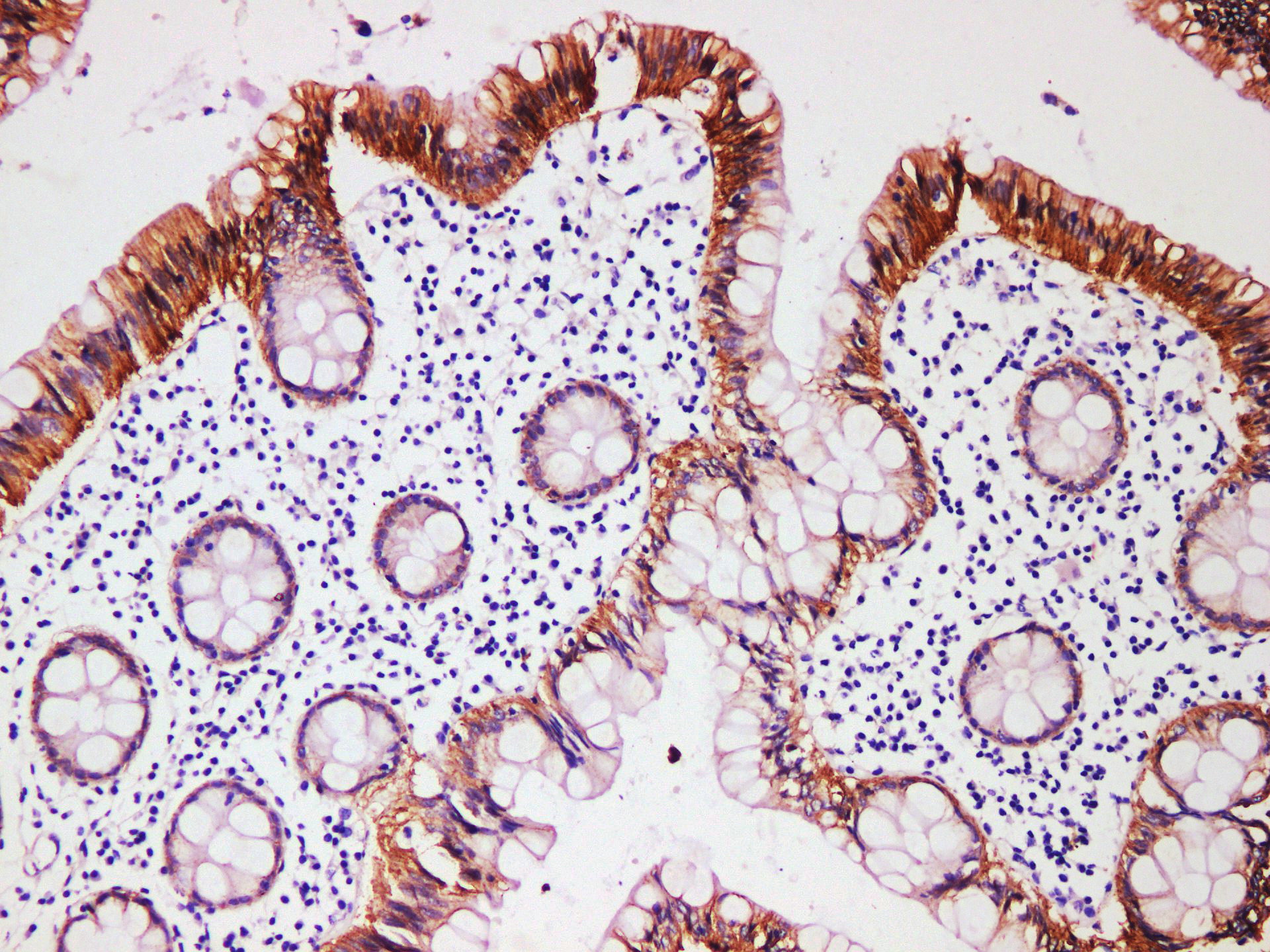 Pathological Antibodies