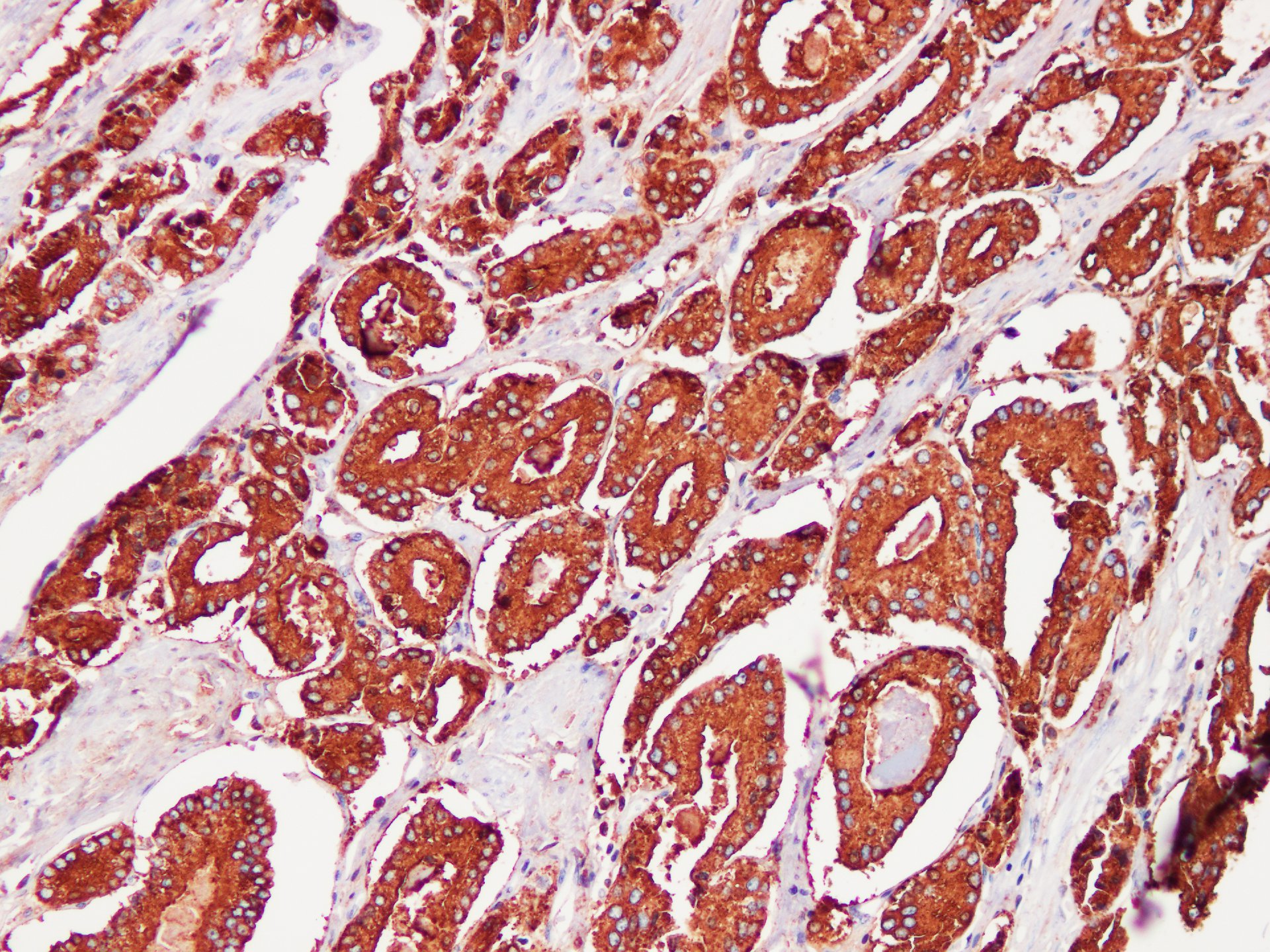 Pathological Antibodies