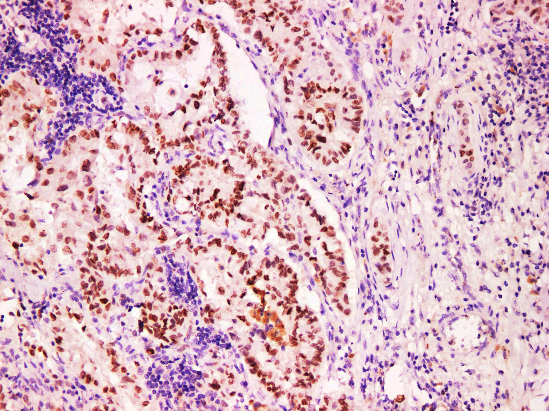 Pathological Antibodies