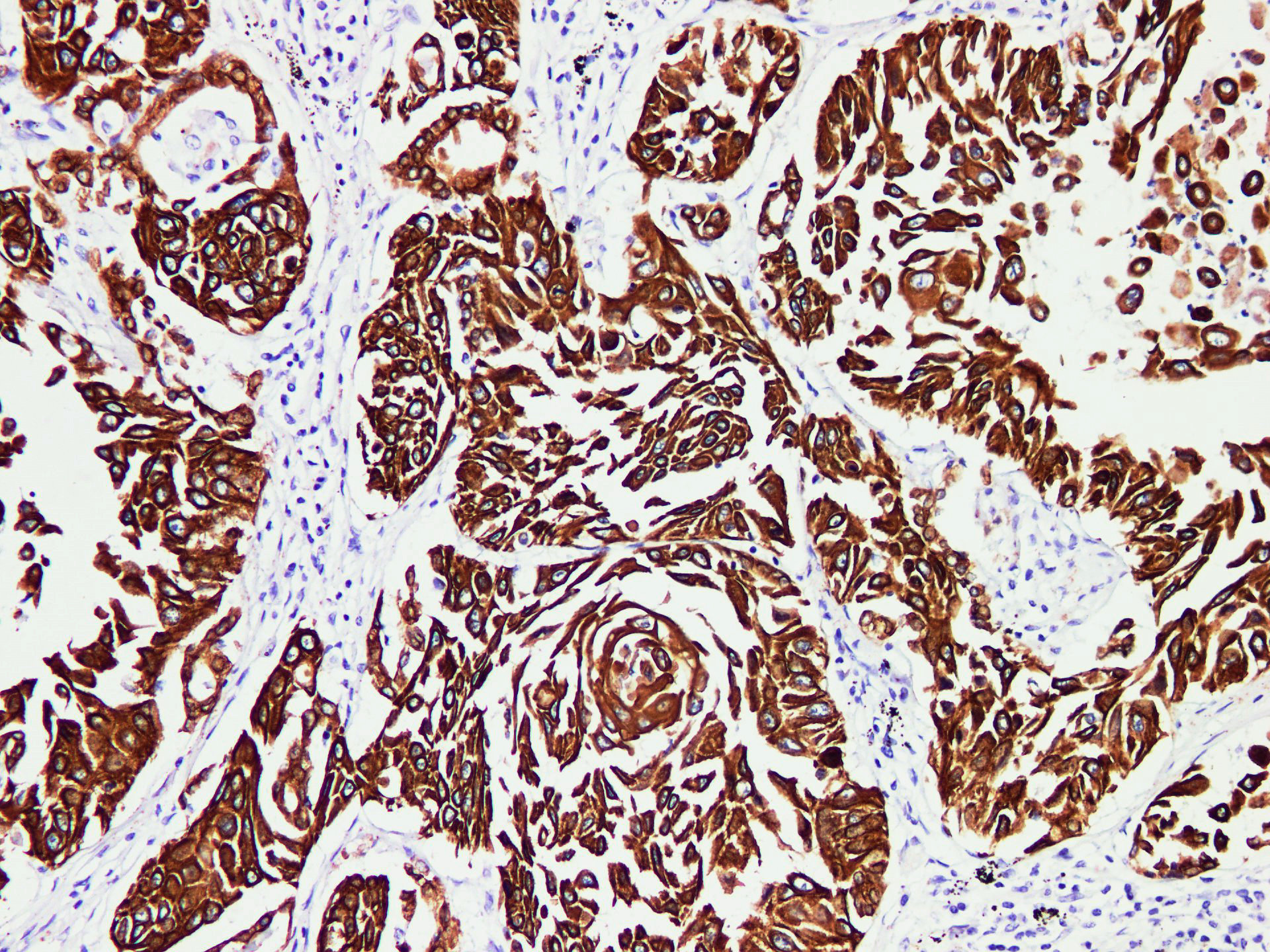 Pathological Antibodies