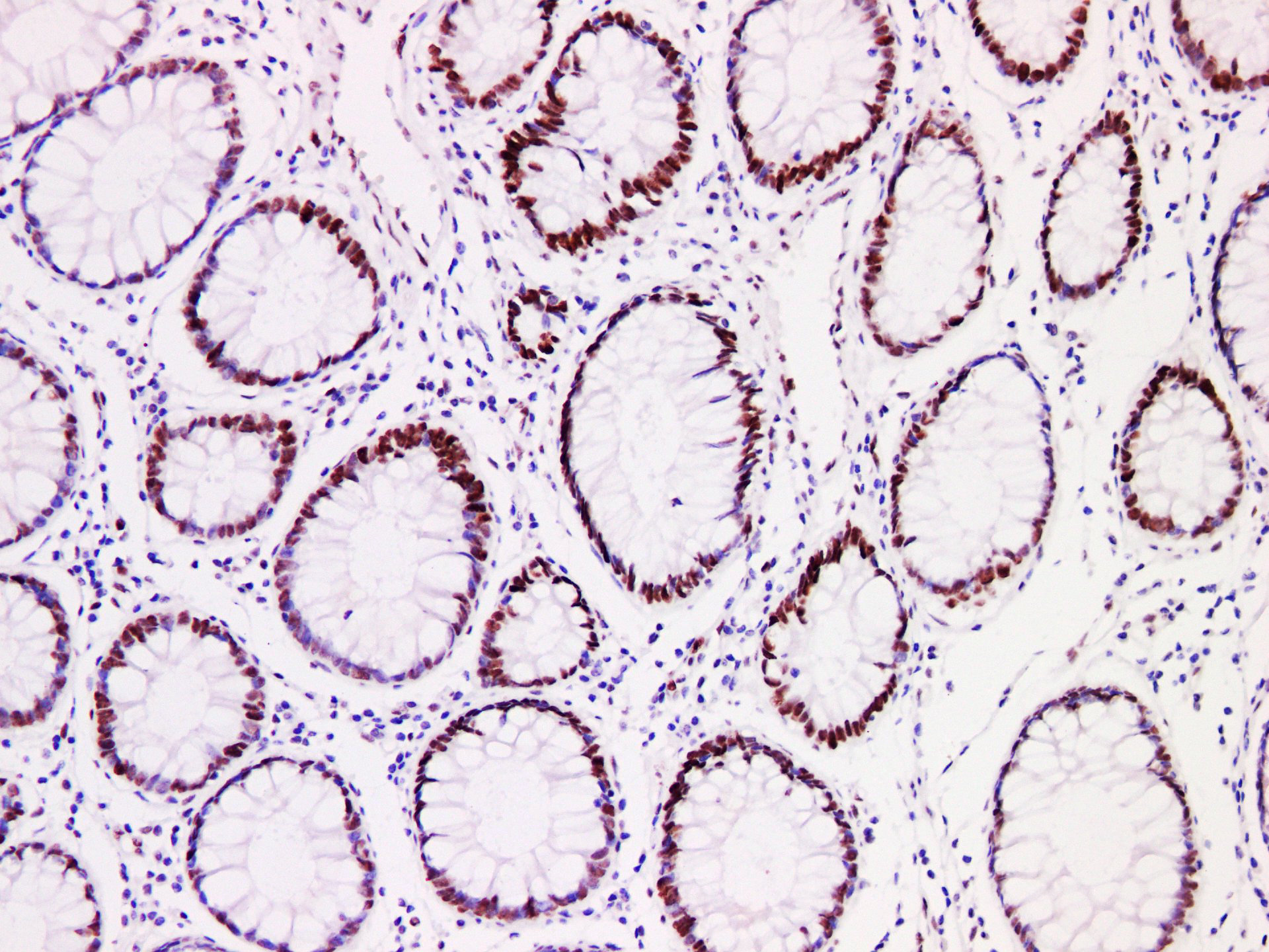 Pathological Antibodies