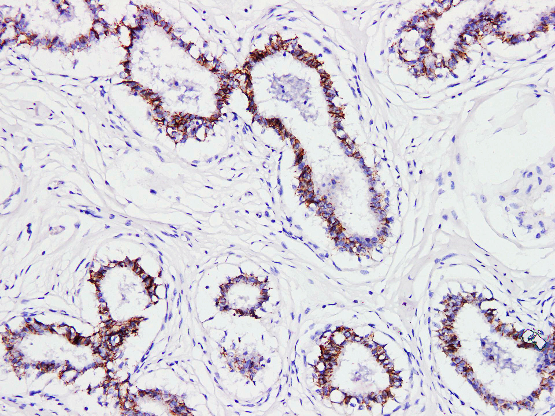 Pathological Antibodies