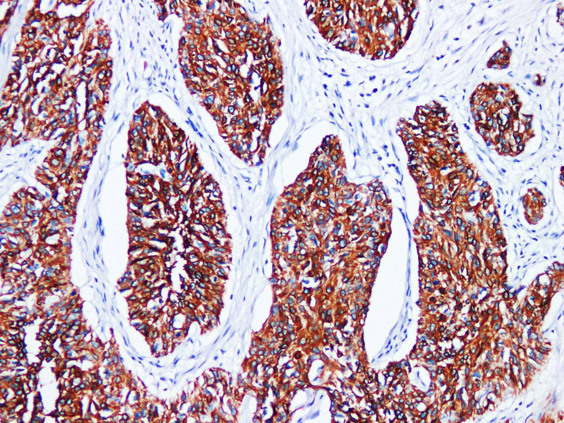 Pathological Antibodies