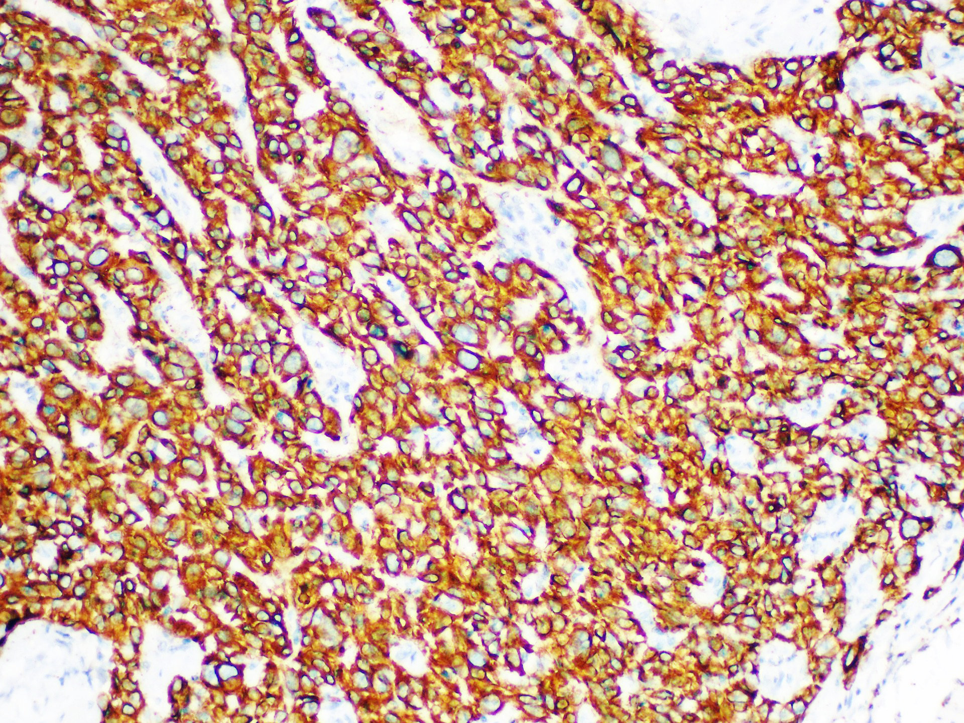 Pathological Antibodies