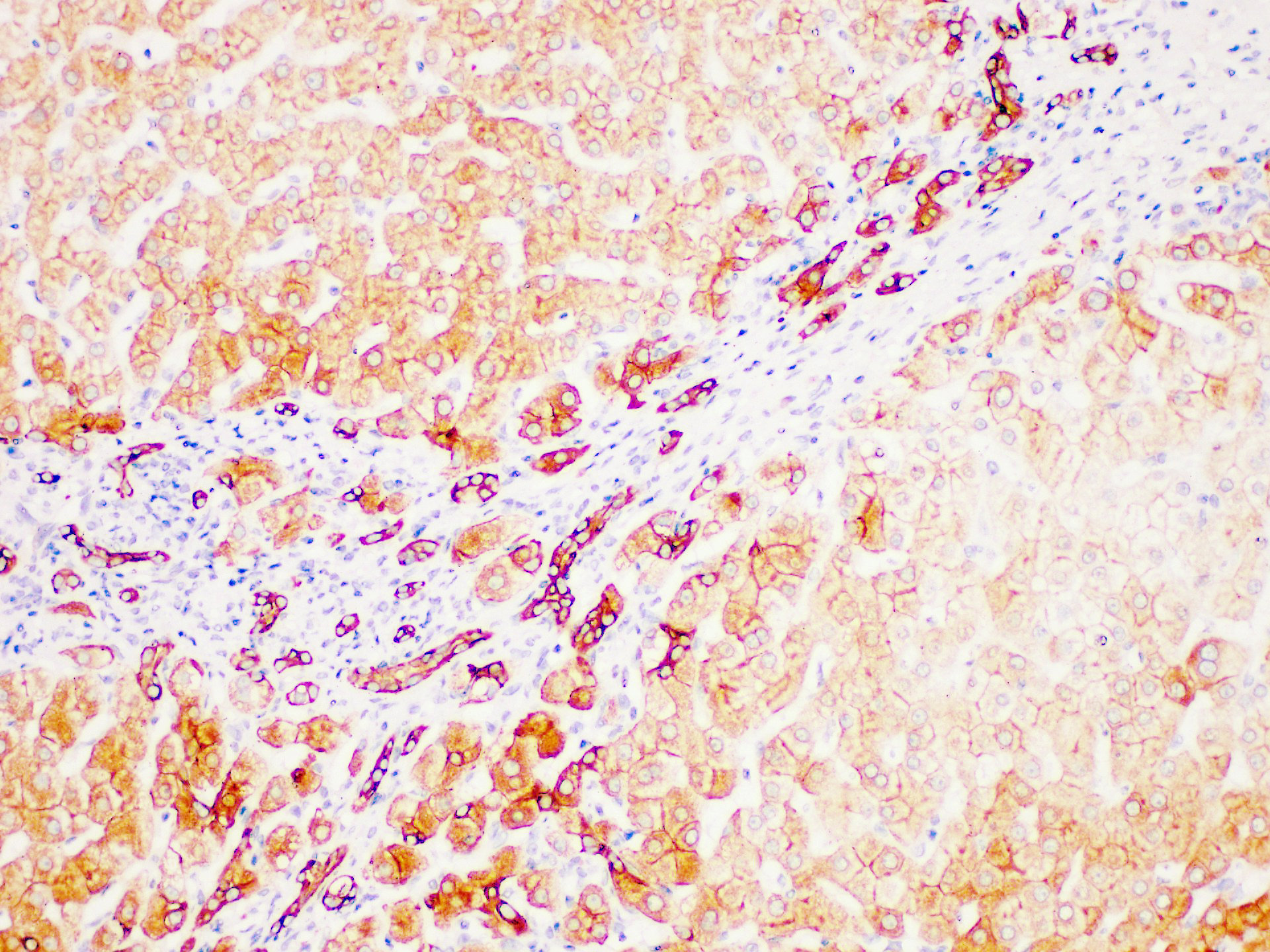 Pathological Antibodies