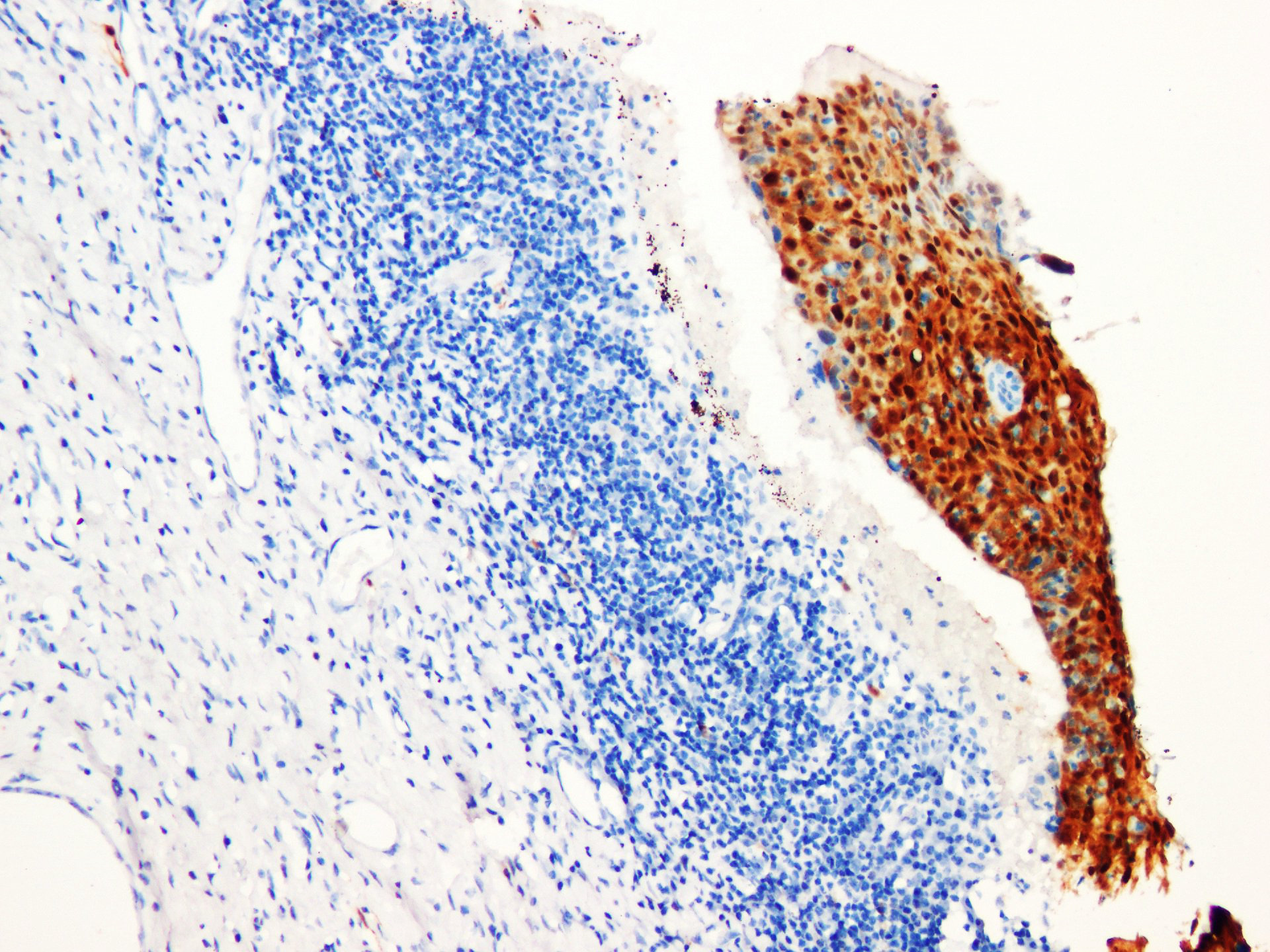 Pathological Antibodies